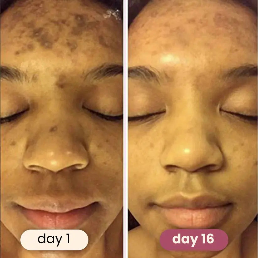 🏆#1 Best Selling🏆 Turmeric Kojic Acid Cleansing Pads gomuto.com