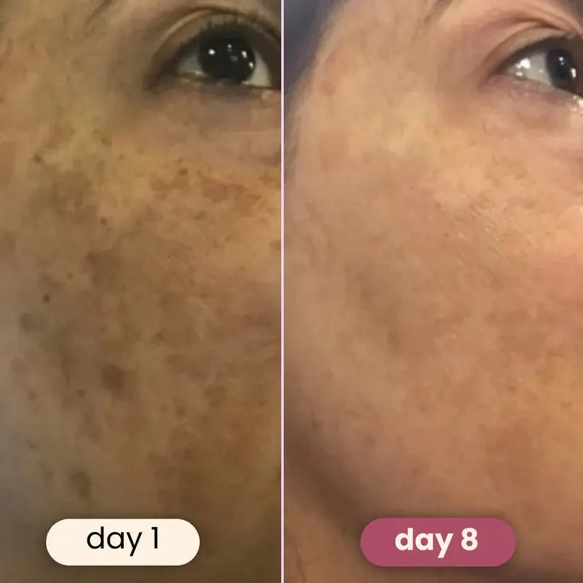 🏆#1 Best Selling🏆 Turmeric Kojic Acid Cleansing Pads gomuto.com