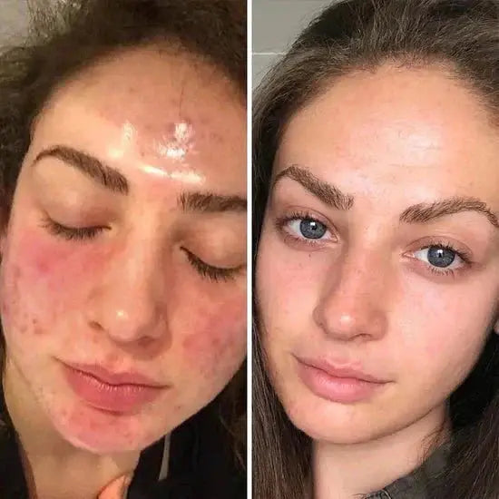 🏆#1 Best Selling🏆 Turmeric Kojic Acid Cleansing Pads gomuto.com