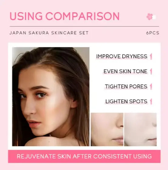 Japan Sakura Blossom Radiance – 6-Piece Skincare Set 🌸 | Deep Hydration & Glow gomuto.com