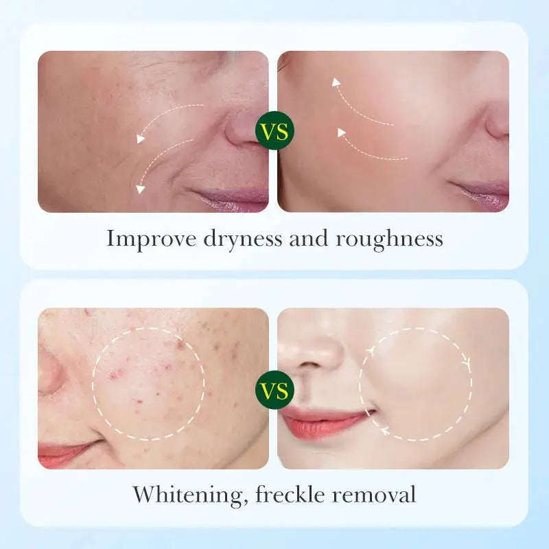 SADOER Licorice Root Whitening Skincare Set – Glow Naturally with Herbal Power 🌿 gomuto.com