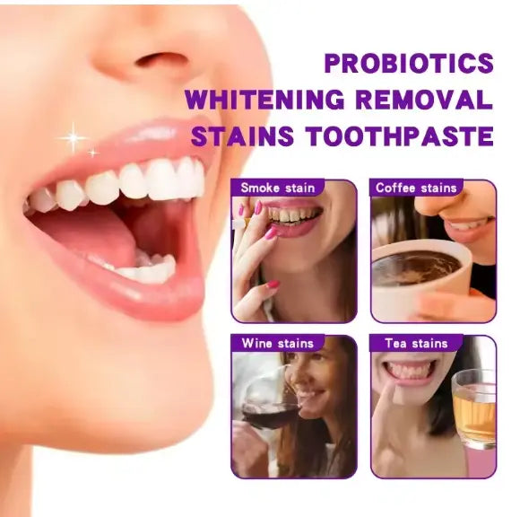 SP-7 Deep Guide White Toothpaste – Intense Whitening with Peppermint Freshness (120g) gomuto.com