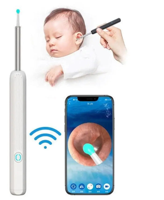 Smart Ear Wax Removal Kit Gomuto
