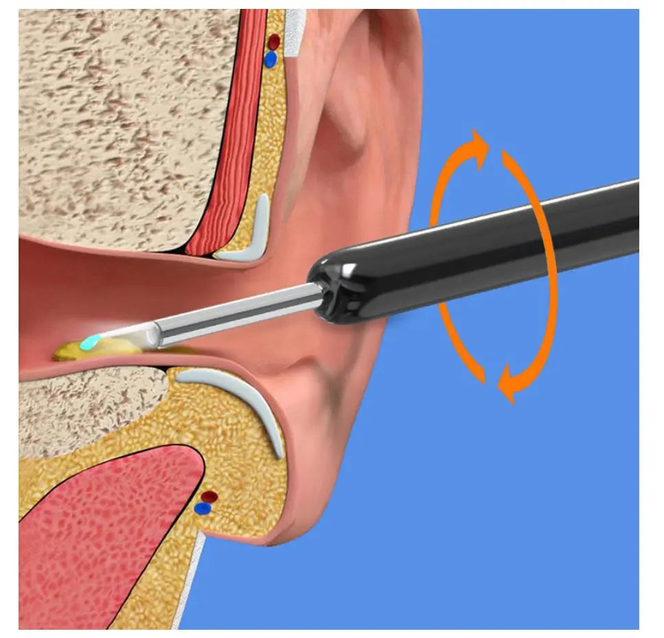 Smart Ear Wax Removal Kit Gomuto